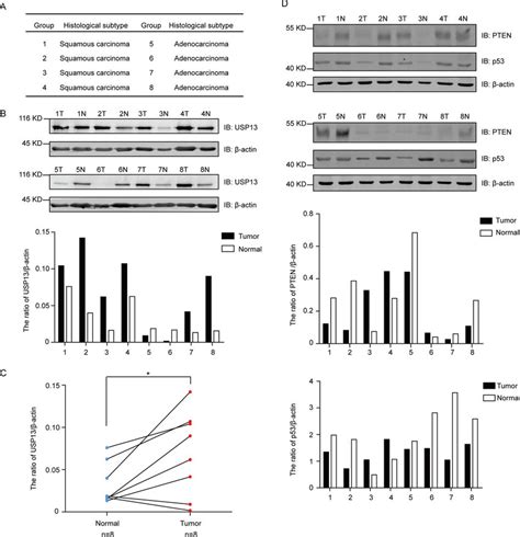 Analysis Of Usp13 Level In Lung Tumor And Adjacent Normal Tissues From