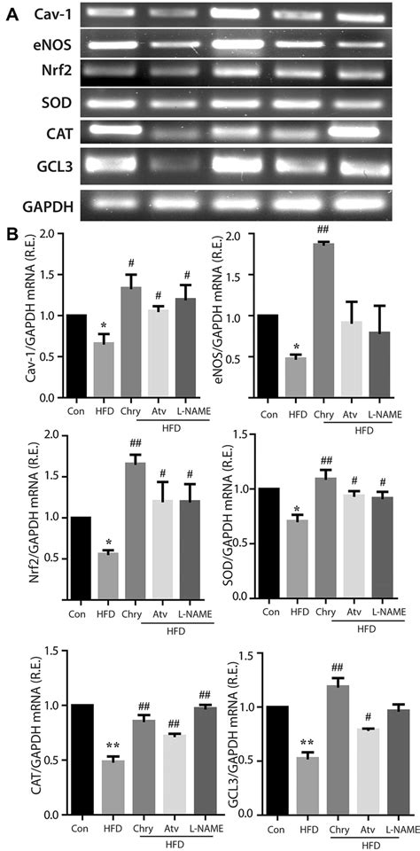 Nrf2 And Its Target Gene Expression By Semi Quantitative RT PCR A