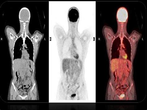 Radionuclide imaging