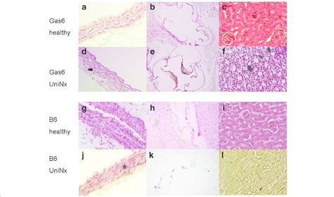 Localisation Of Calcium Deposits Von Kossa Staining Of The Aorta A Download Scientific