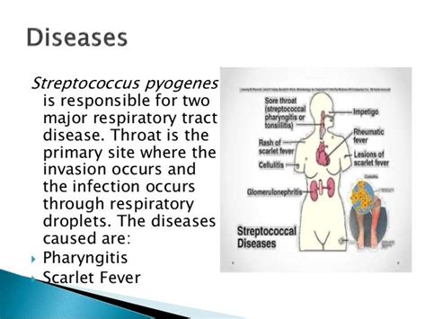 Streptococcus pyogenes