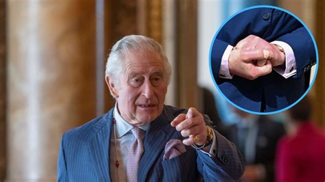 King Charles' Fingers: Photos of His Swollen Hands | In Touch Weekly