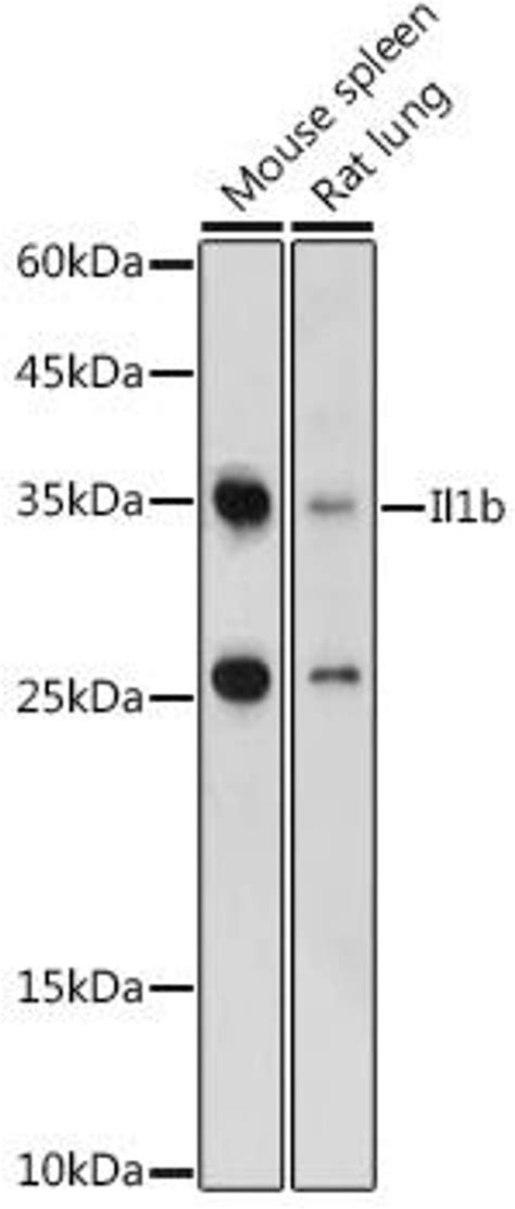 Anti Il1b 抗体 Assay Genie