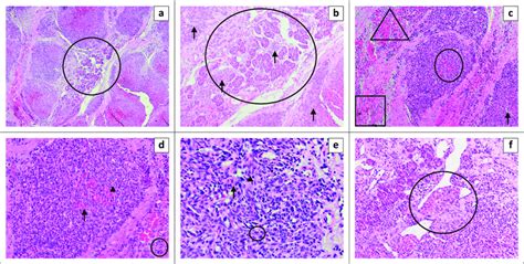 Photon Microscopy Of The Pancreatic Histology Specimen With Different