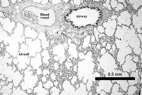 Alveoli Slide