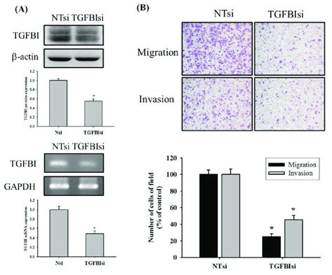 Effects Of Tgfbi Knockdown On Cell Migration And Invasion Of U Os