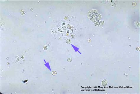 RBC and WBC in Urine Sediment | Medical Laboratories