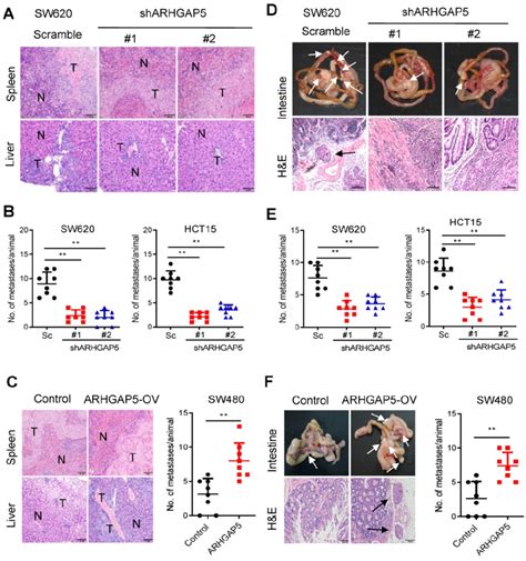 Effects Of Arhgap5 Knockdown Or Arhgap5 Overexpression On Crc