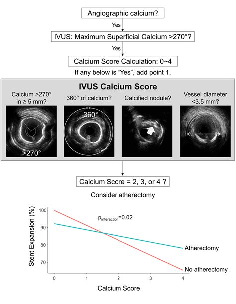 Intravascular Ultrasoundderived Calcium Score To Predict Stent