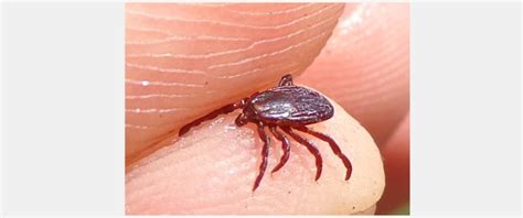 Tick Bites On Humans Treatment