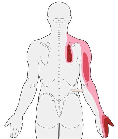 Self Care Scalene Pain Of Upper Back Arm Hand Artofit