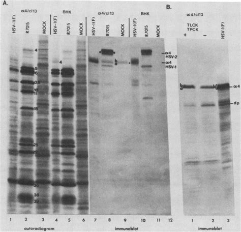 Autoradiographic Images And Immunoblots Of Mock Infected And