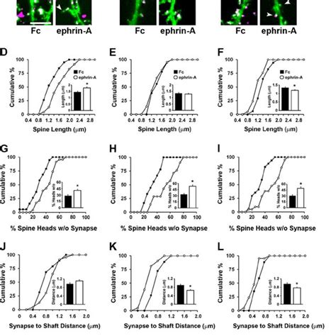 Time Dependent Effects On Spine Morphology And Synapses By Epha