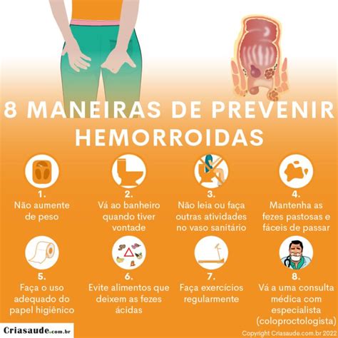 8 Maneiras De Prevenir Hemorroidas Dicas De Um Especialista Criasaude