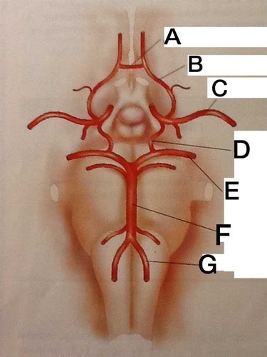 Intracranial Cerebrovascular Anatomy Flashcards Quizlet