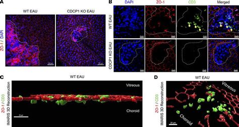 JCI Insight CDCP1 Regulates Retinal Pigmented Epithelial Barrier