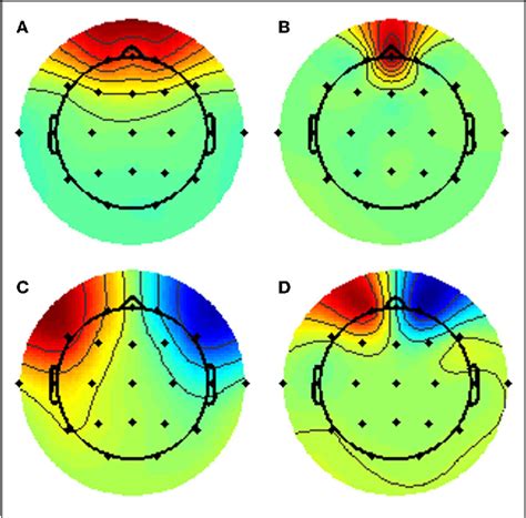 Eeg Spectral Features Discriminate Between Alzheimers And Vascular