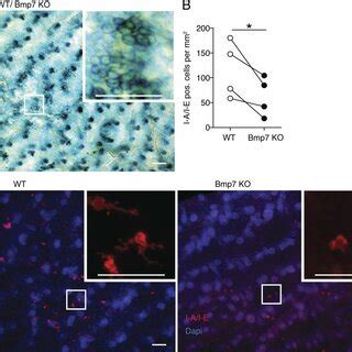 BMP7 Expression Is Detectable In The Basal Epidermis During Human