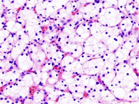 Principle of Hematoxylin and Eosin Staining Archives - LaboratoryTests.org