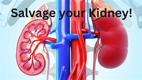 How To Prevent Kidney Diseases And Failure Simple Steps To Keep Your