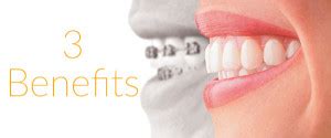 Benefits Of Invisalign That You Need To Know Verve Orthodontics