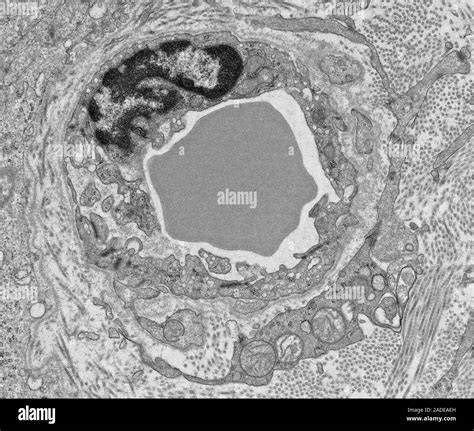 Capillary And Red Blood Cell Black And White Transmission Electron