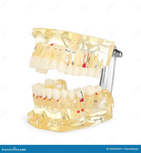 Modelo De Typodont Dental Educativo Aislado En Blanco Imagen De Archivo