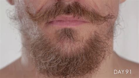 Facial Hair Growing For 100 Days In Time Lapse Youtube