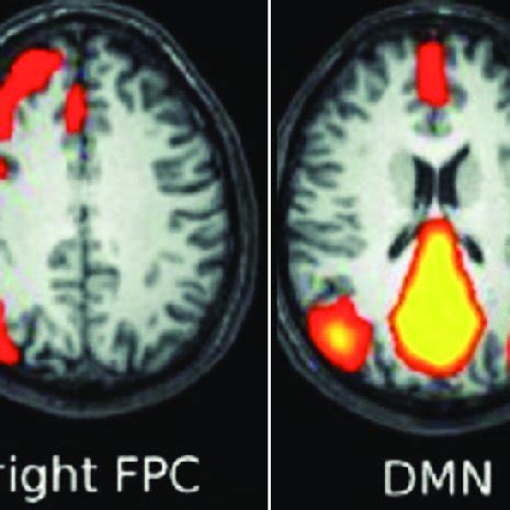 Four Major Rsns Revealed By Ica Dan Dorsal Attention Network Dmn