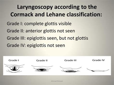 Ppt Airway Management Part Ii Powerpoint Presentation Id2062816