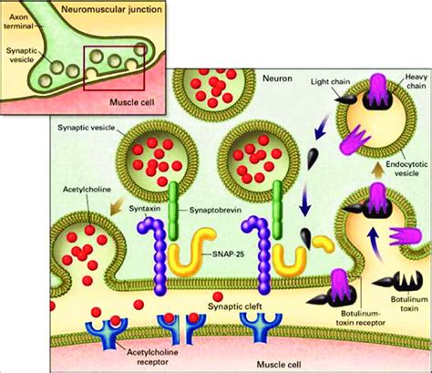 Clostridium Botulinum Pathogenesis