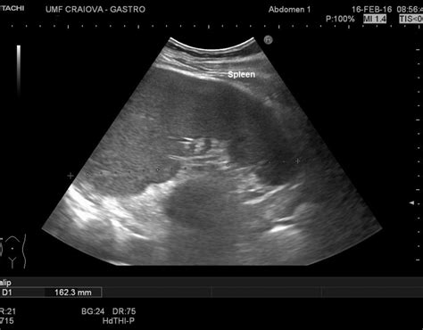 BASIC ULTRASOUND IMAGES – EFSUMB