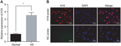 Silencing Of Long Non Coding Rna H Downregulates Ctcf To Protect