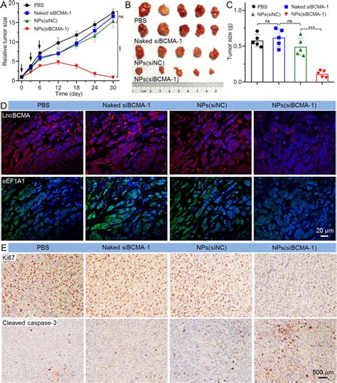 Nps Mediated Lncbcma Silencing Inhibits Tnbc Growth And Metastasis In