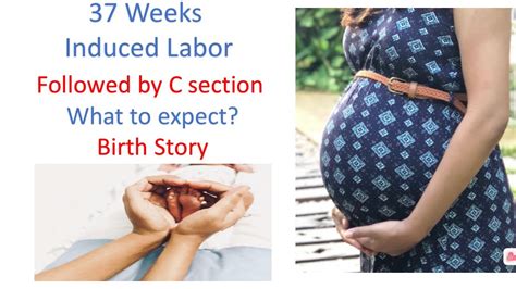 37 Weeks Induced Labor And Then C Section YouTube