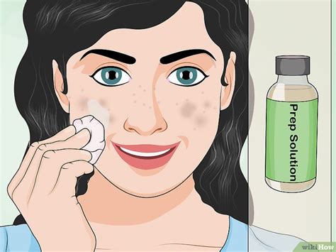 Como Aplicar Um Peeling De Cido Tricloroac Tico