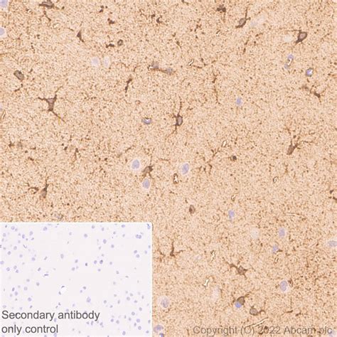 Anti Aldolase C N terminal 抗体 EPR26895 52 BSA and Azide free