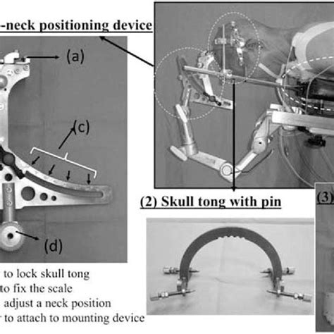 The Novel Skull Clamp Positioning Device The Device Comprises 3 Main Download Scientific