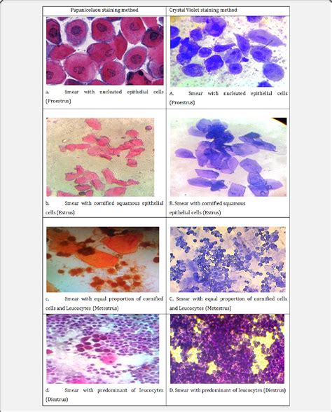 Figure 3 From A Comparative Study On Staining Techniques For Vaginal