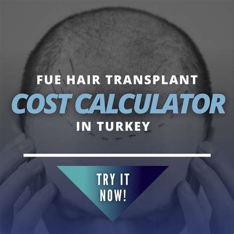 Hair Transplant In Turkey Cost Calculator Check Exact Cost