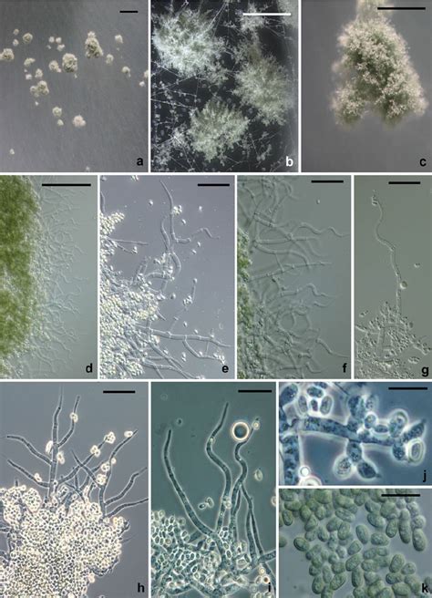 Trichoderma Barbatum A C Pustules On Cmd D F Hairs On Conidial