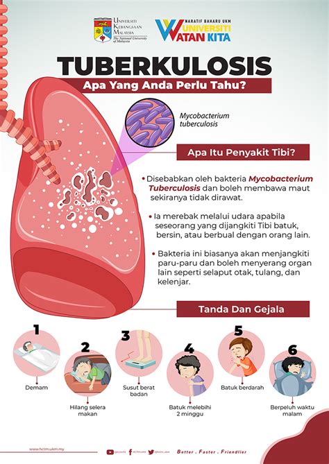 Tuberkulosis Apa Perlu Anda Tahu Unit Keselamatan Dan Kesihatan