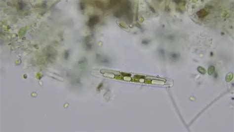 Diatoms A Complete Overview Microscope Clarity