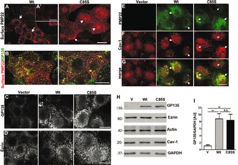 Palmitoylation Of Pmp22 Influences The Cell Surface Distribution Of The