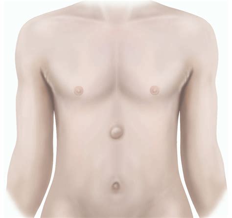 Xiphoid Process Lump