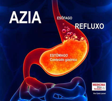 Azia e indigestão causas sintomas e tratamento Medicina Mitos e