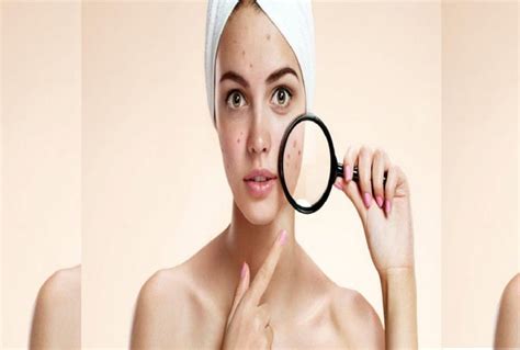 Skin Care Tips Bad Habits That Causes Pimples And Acne On Face Amar