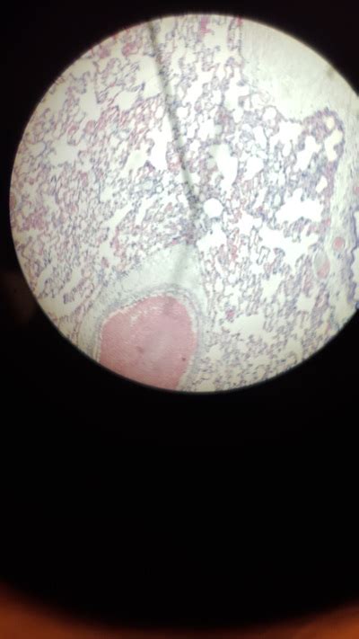 Seeing Alveoli under the microscope - A Level Revision