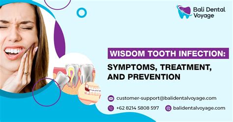 Early Stage Wisdom Tooth Infection, Symptoms, and Treatment