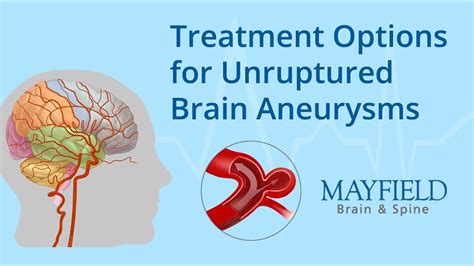 Treatment Options For Unruptured Brain Aneurysms Youtube